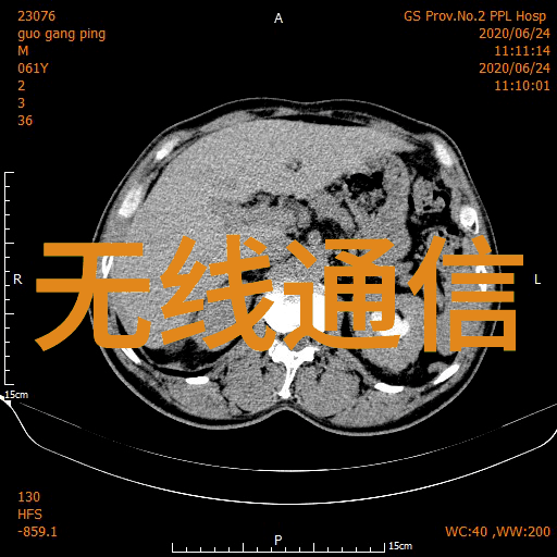 不锈钢丝网填料网耐腐蚀的选择高效过滤的秘诀